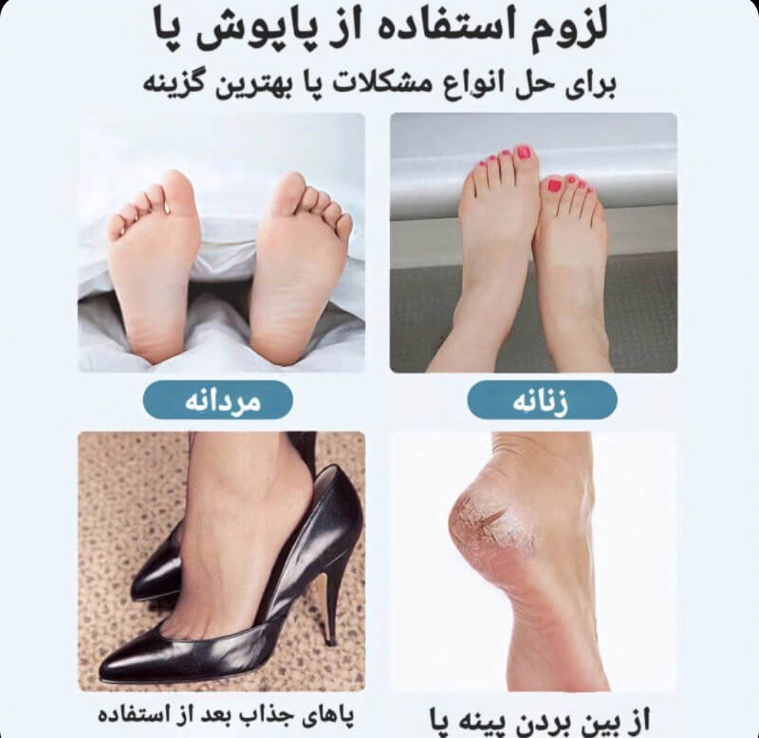 پاپوش مخصوص درمان ترک پا و خشکی پا 2 پاپوش مخصوص درمان ترک پا و خشکی پا - Image 2
